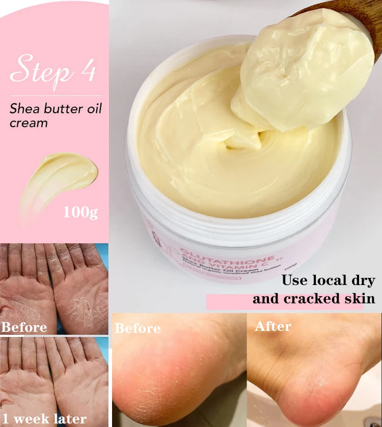 AILKE Whitening Skin Cream With Glutathione And Shea Butter
