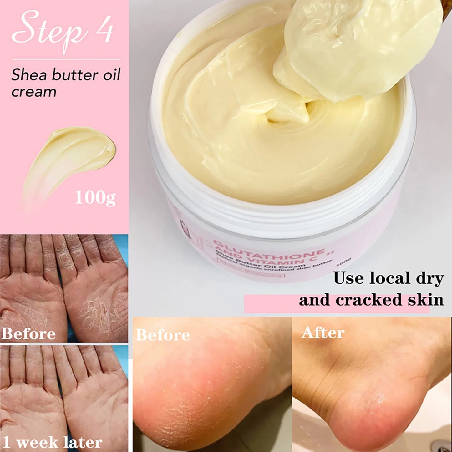 AILKE Whitening Skin Cream With Glutathione And Shea Butter