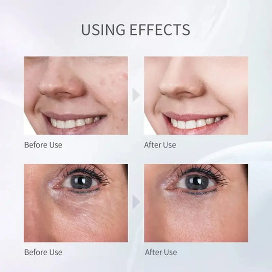 Advanced Ultrasonic Electric Facial Skin Scrubber for Deep Cleansing and Exfoliation at Home - Rejuvenate Your Skin with this Ul