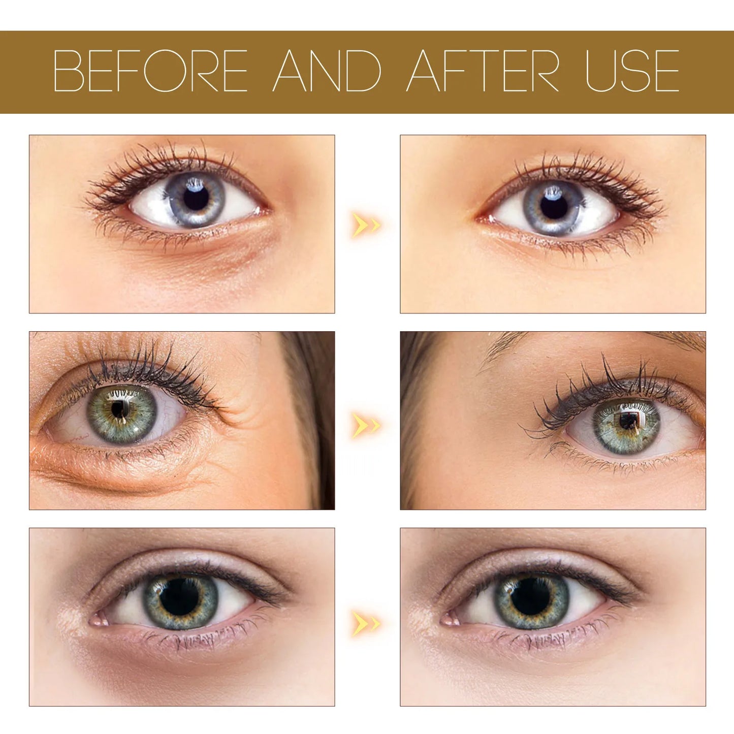 EELHOE Coffee Eye Lifting Essence Dark Circles and Pores Reduces Fine Lines Moisturizing and Nourishing Eye Treatment Essence